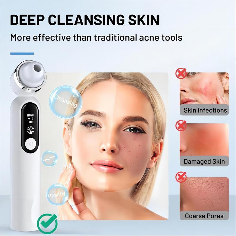 Visible Exfoliator Vacuum Cleaner, Skin Scrubber with Camera, Pore Cleaner with Three Modes, USB Rechargeable, Cleansing Skincare for All Gender